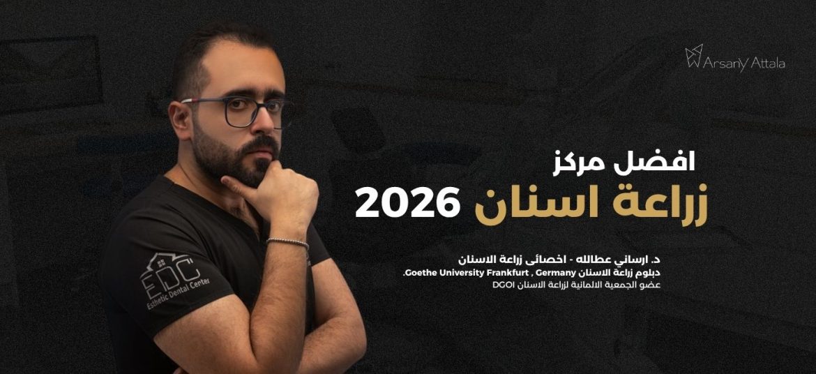 أفضل مركز زراعة أسنان في مصر 2026: كيف تختار المكان المناسب؟
