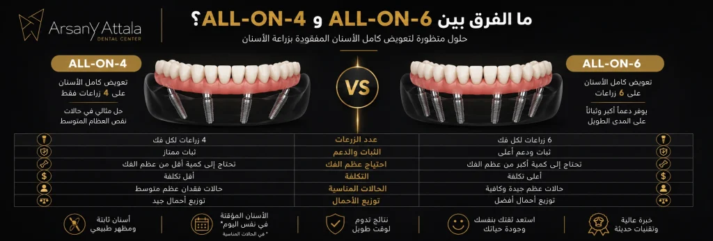 مقارنة بين نظامي زراعة الأسنان All-on-4 و All-on-6 توضح عدد الزراعات، الثبات، احتياج عظم الفك، التكلفة، والحالات المناسبة لكل نظام في مركز د. أرساني عطالله.