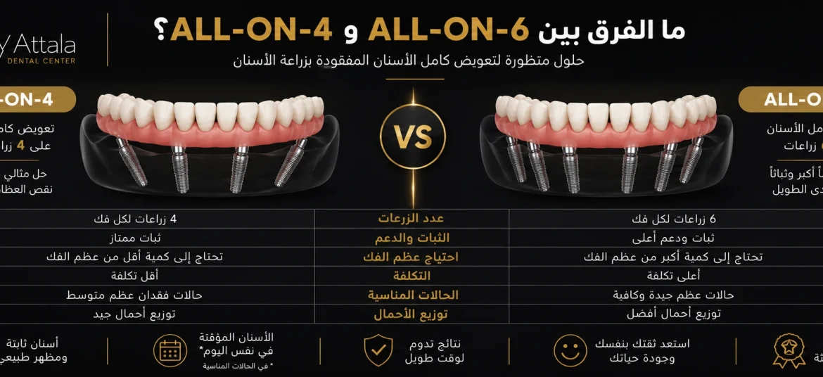 ما الفرق بين All-on-4 و All-on-6؟