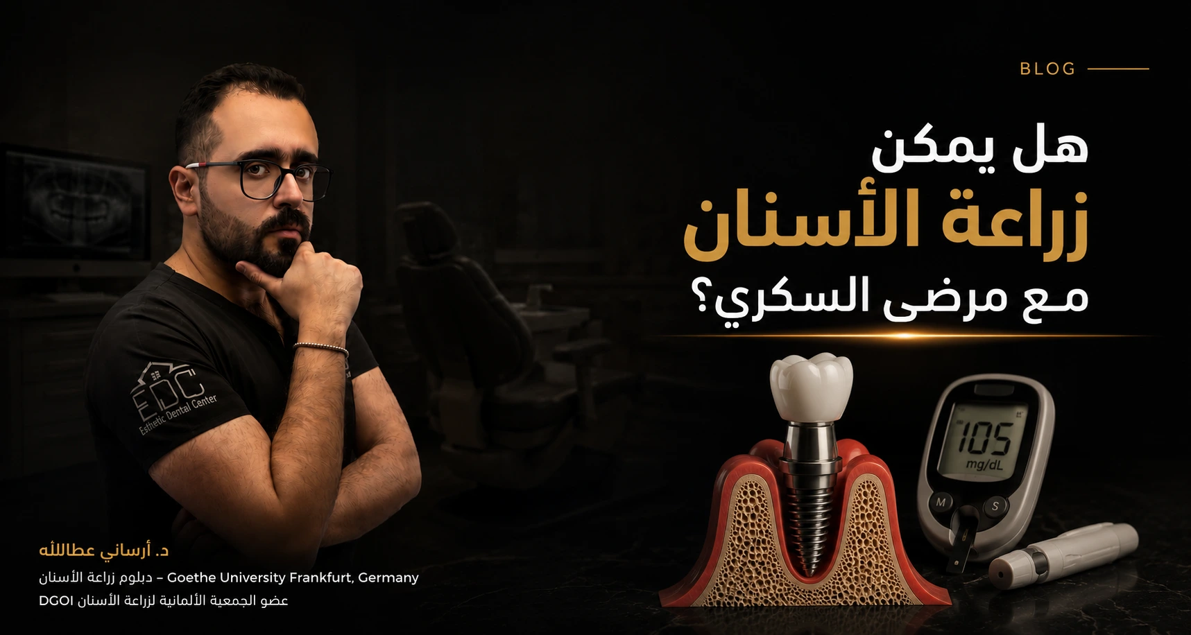 هل يمكن زراعة الأسنان مع مرضى السكري؟ د. أرساني عطالله يوضح شروط نجاح زراعة الأسنان لمرضى السكري بعد التحكم في مستوى السكر.