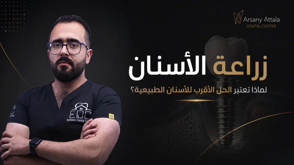 زراعة الأسنان - لماذا تعتبر الحل الأقرب للأسنان الطبيعية؟ | د. أرساني عطالله