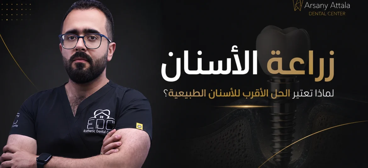 زراعة الأسنان في 2026: لماذا تعتبر الحل الأقرب للأسنان الطبيعية؟