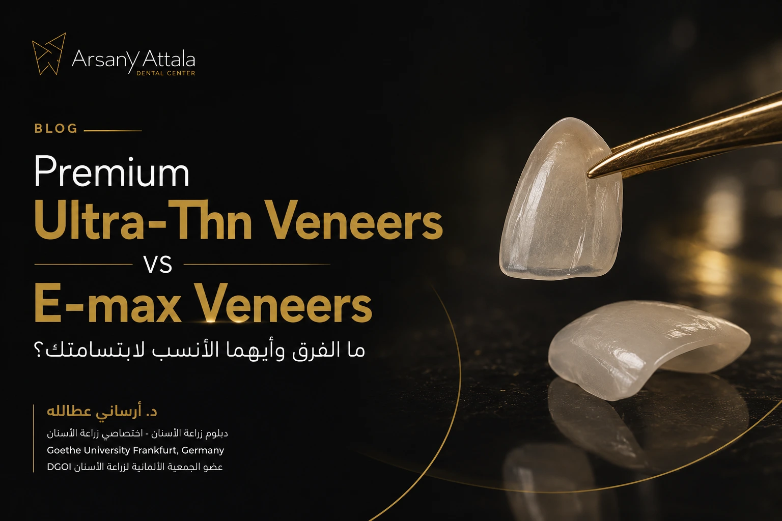 Premium Ultra-Thin Veneers vs E-max Veneers - الفرق بين العدسات فائقة الرقة وخامة E-max لتجميل الأسنان
